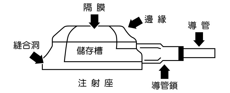 人工靜脈植入器的組件介紹