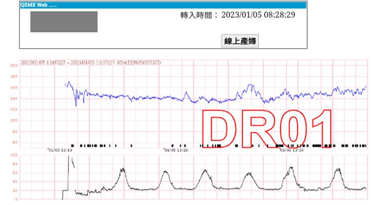 自行開發胎兒監視器傳輸平台後,不僅達到無紙化,報告也更清晰。