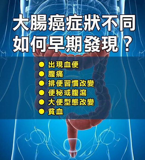 大腸癌症狀