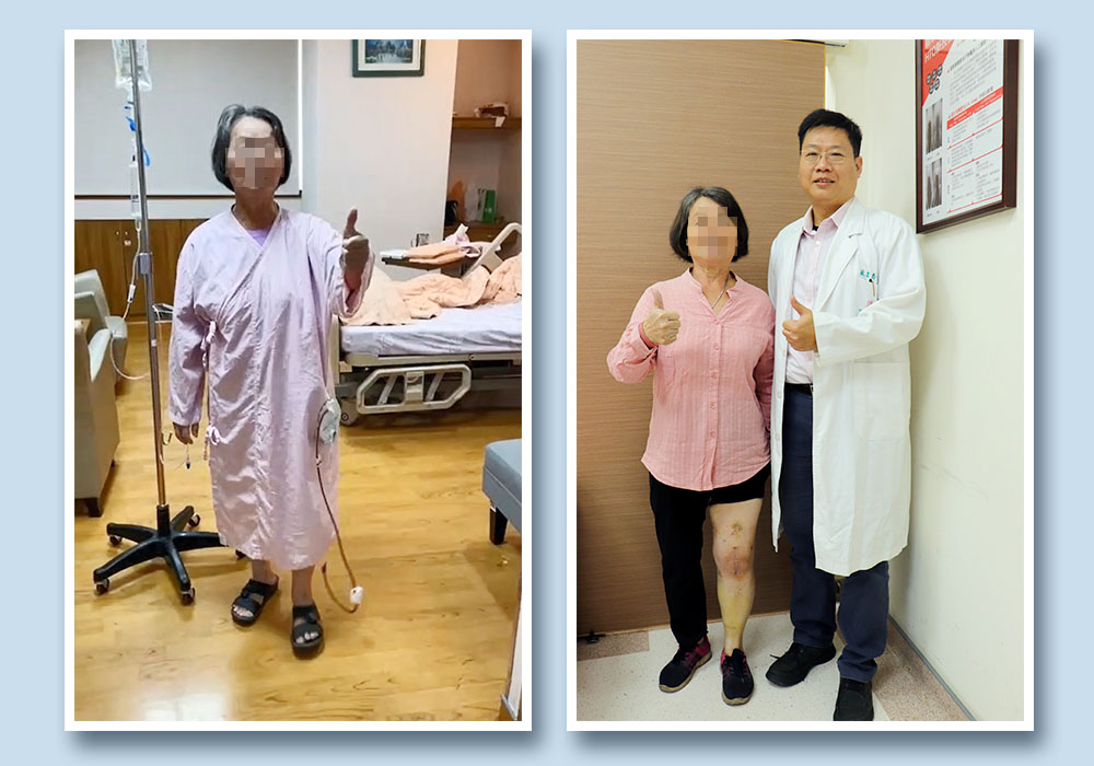 車禍加重退化性膝關節炎  羅莎手術助迅速康復